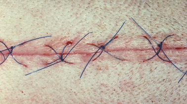 Surgeons in sterile field